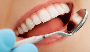 Восстановление анатомической формы зуба